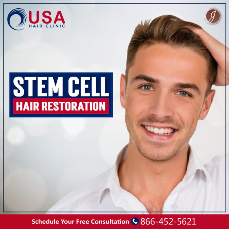 stem cell hair transplant