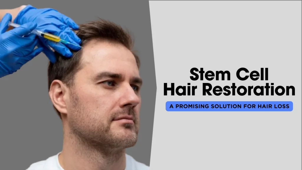 Smartgraft Hair Restoration